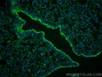 SLC6A14 Antibody in Immunohistochemistry (PFA fixed) (IHC (PFA))