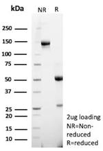 HBEGF/DTR Antibody in SDS-PAGE (SDS-PAGE)