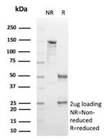 HBEGF/DTR Antibody in SDS-PAGE (SDS-PAGE)