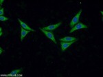 FASTKD3 Antibody in Immunocytochemistry (ICC/IF)
