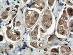 FASTKD3 Antibody in Immunohistochemistry (Paraffin) (IHC (P))