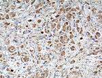 FASTKD3 Antibody in Immunohistochemistry (Paraffin) (IHC (P))