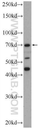 FASTKD3 Antibody in Western Blot (WB)