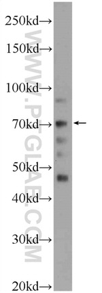 FASTKD3 Antibody in Western Blot (WB)