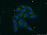 PSAP Antibody in Immunocytochemistry (ICC/IF)