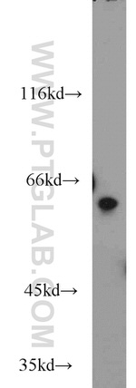 PSAP Antibody in Western Blot (WB)