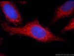 TOMM40 Antibody in Immunocytochemistry (ICC/IF)