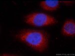 TOMM40 Antibody in Immunocytochemistry (ICC/IF)