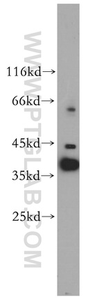 TOMM40 Antibody in Western Blot (WB)
