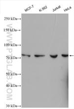 SPATA5L1 Antibody in Western Blot (WB)