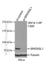 SPATA5L1 Antibody in Western Blot (WB)