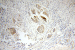 FAM84B Antibody in Immunohistochemistry (Paraffin) (IHC (P))