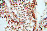 FAM84B Antibody in Immunohistochemistry (Paraffin) (IHC (P))