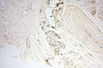 FAM84B Antibody in Immunohistochemistry (Paraffin) (IHC (P))