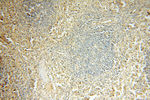 FAM84B Antibody in Immunohistochemistry (Paraffin) (IHC (P))