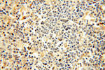 FAM84B Antibody in Immunohistochemistry (Paraffin) (IHC (P))