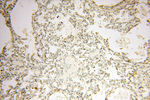 FAM84B Antibody in Immunohistochemistry (Paraffin) (IHC (P))