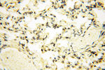 FAM84B Antibody in Immunohistochemistry (Paraffin) (IHC (P))