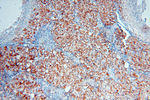 FAM84B Antibody in Immunohistochemistry (Paraffin) (IHC (P))