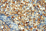 FAM84B Antibody in Immunohistochemistry (Paraffin) (IHC (P))