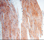 FAM84B Antibody in Immunohistochemistry (Paraffin) (IHC (P))