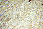 FAM84B Antibody in Immunohistochemistry (Paraffin) (IHC (P))