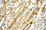 FAM84B Antibody in Immunohistochemistry (Paraffin) (IHC (P))