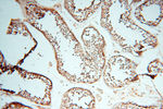 FAM84B Antibody in Immunohistochemistry (Paraffin) (IHC (P))