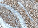 FAM84B Antibody in Immunohistochemistry (Paraffin) (IHC (P))