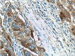 FAM84B Antibody in Immunohistochemistry (Paraffin) (IHC (P))