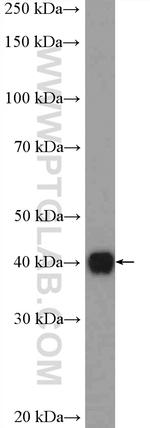 FAM84B Antibody in Western Blot (WB)