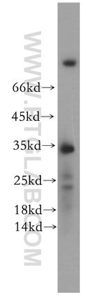 FAM84B Antibody in Western Blot (WB)