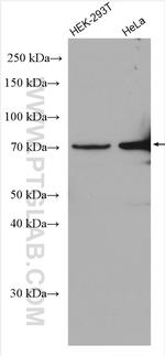 PSAP Antibody in Western Blot (WB)