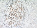 PRMT5 Antibody in Immunohistochemistry (Paraffin) (IHC (P))