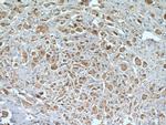 PRMT5 Antibody in Immunohistochemistry (Paraffin) (IHC (P))