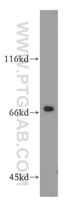 PRMT5 Antibody in Western Blot (WB)