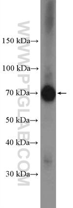 PRMT5 Antibody in Western Blot (WB)