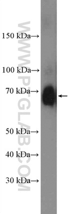 PRMT5 Antibody in Western Blot (WB)