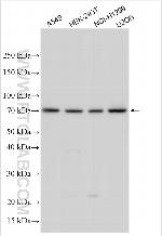 CYBA Antibody in Western Blot (WB)