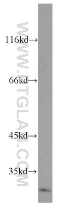 Cathepsin V Antibody in Western Blot (WB)