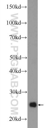 UQCRFS1 Antibody in Western Blot (WB)