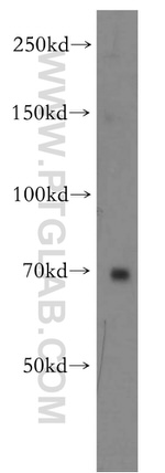 TRIM41 Antibody in Western Blot (WB)