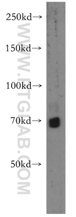 TRIM41 Antibody in Western Blot (WB)