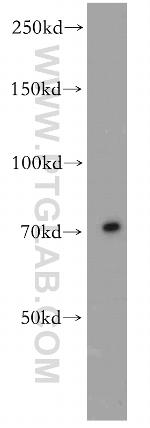 TRIM41 Antibody in Western Blot (WB)