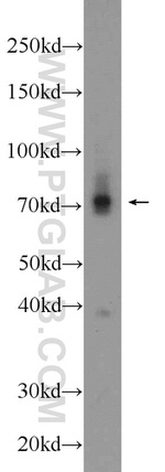 TRIM41 Antibody in Western Blot (WB)