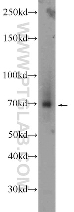 TRIM41 Antibody in Western Blot (WB)
