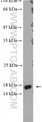 MLANA Antibody in Western Blot (WB)