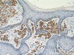 MLANA Antibody in Immunohistochemistry (Paraffin) (IHC (P))