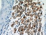 MLANA Antibody in Immunohistochemistry (Paraffin) (IHC (P))