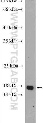 MLANA Antibody in Western Blot (WB)